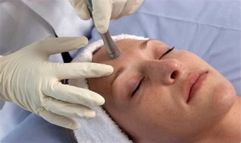 mechanical exfoliation for face.